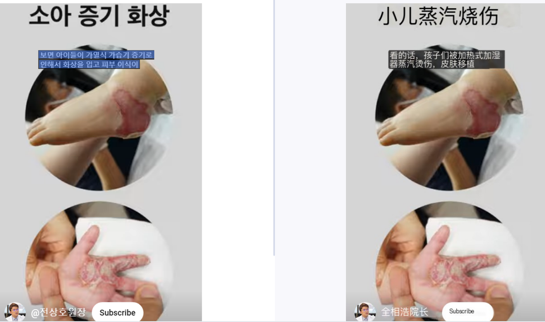 Achten Sie auf Verbrennungsunfälle bei der Nutzung von Dampfbefeuchtern